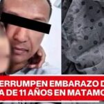 NIÑA DE 11 AÑOS ES ATENDIDA TRAS ABUSO